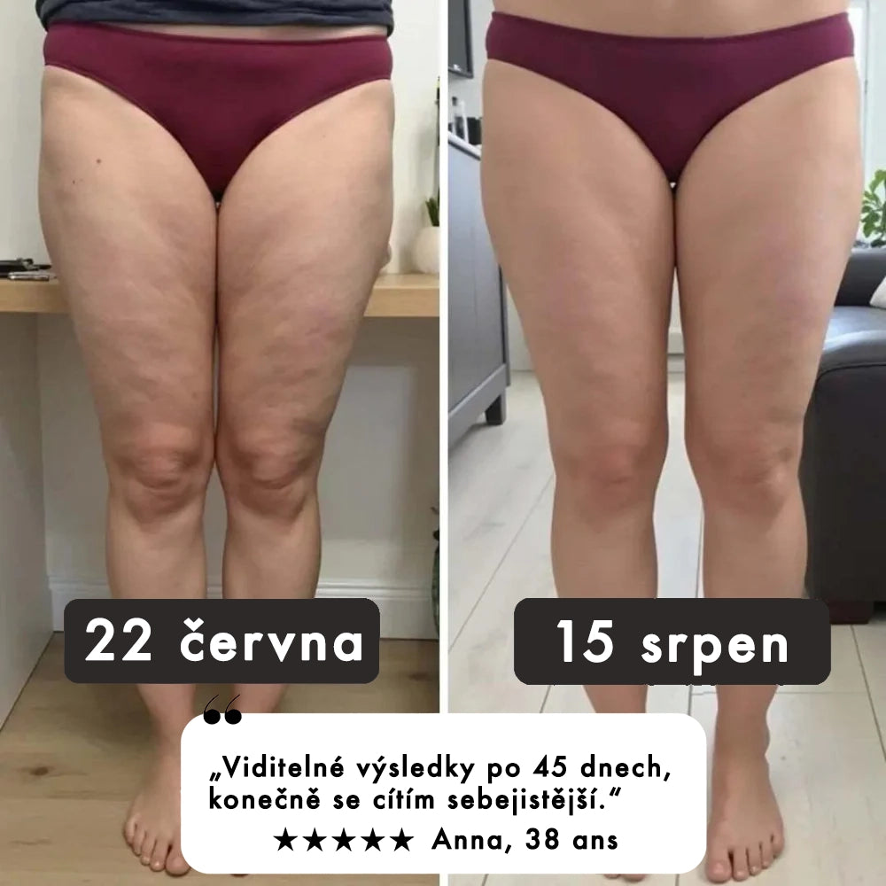 Legíny FitSlim 3D zeštíhlující